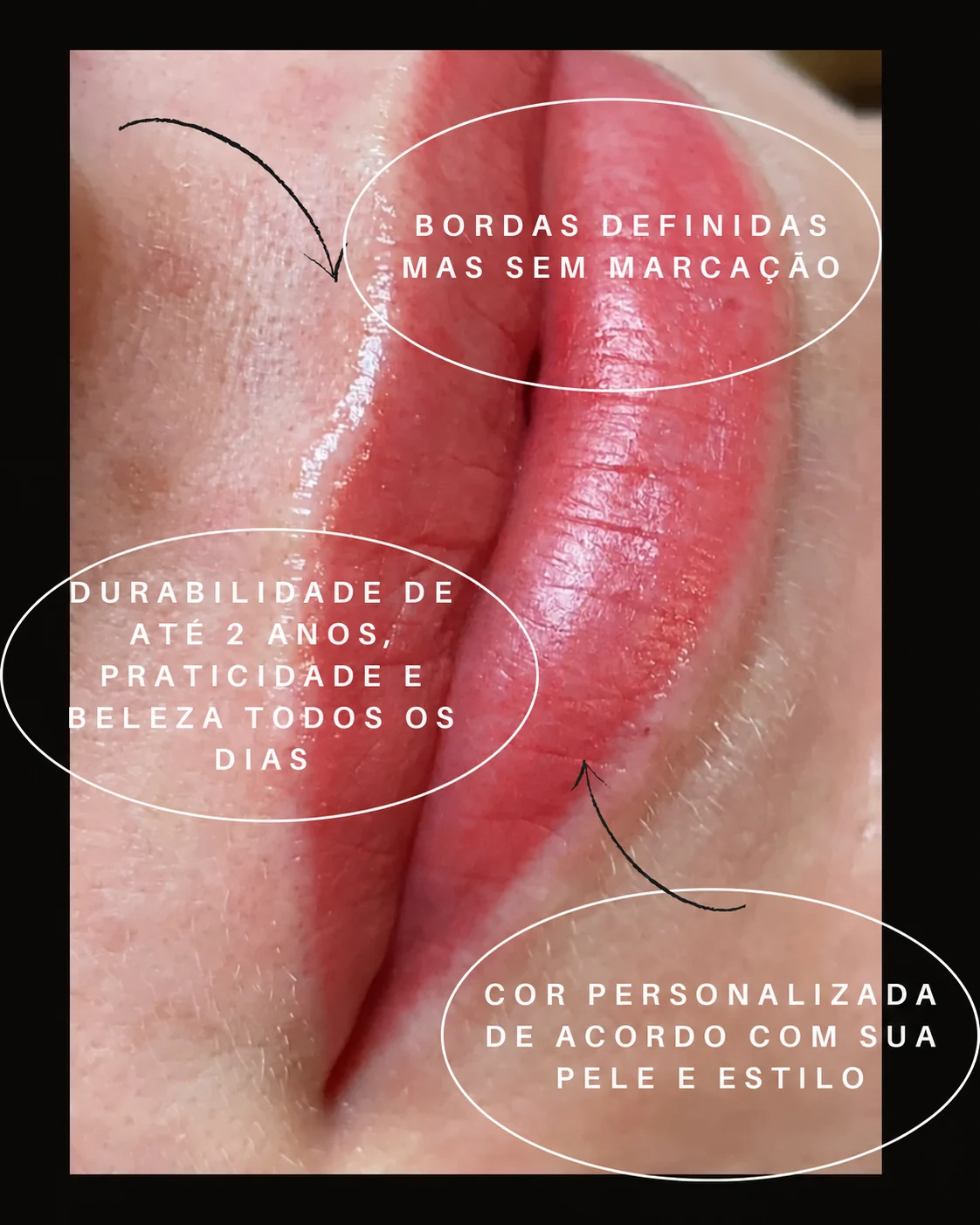 Técnica 1